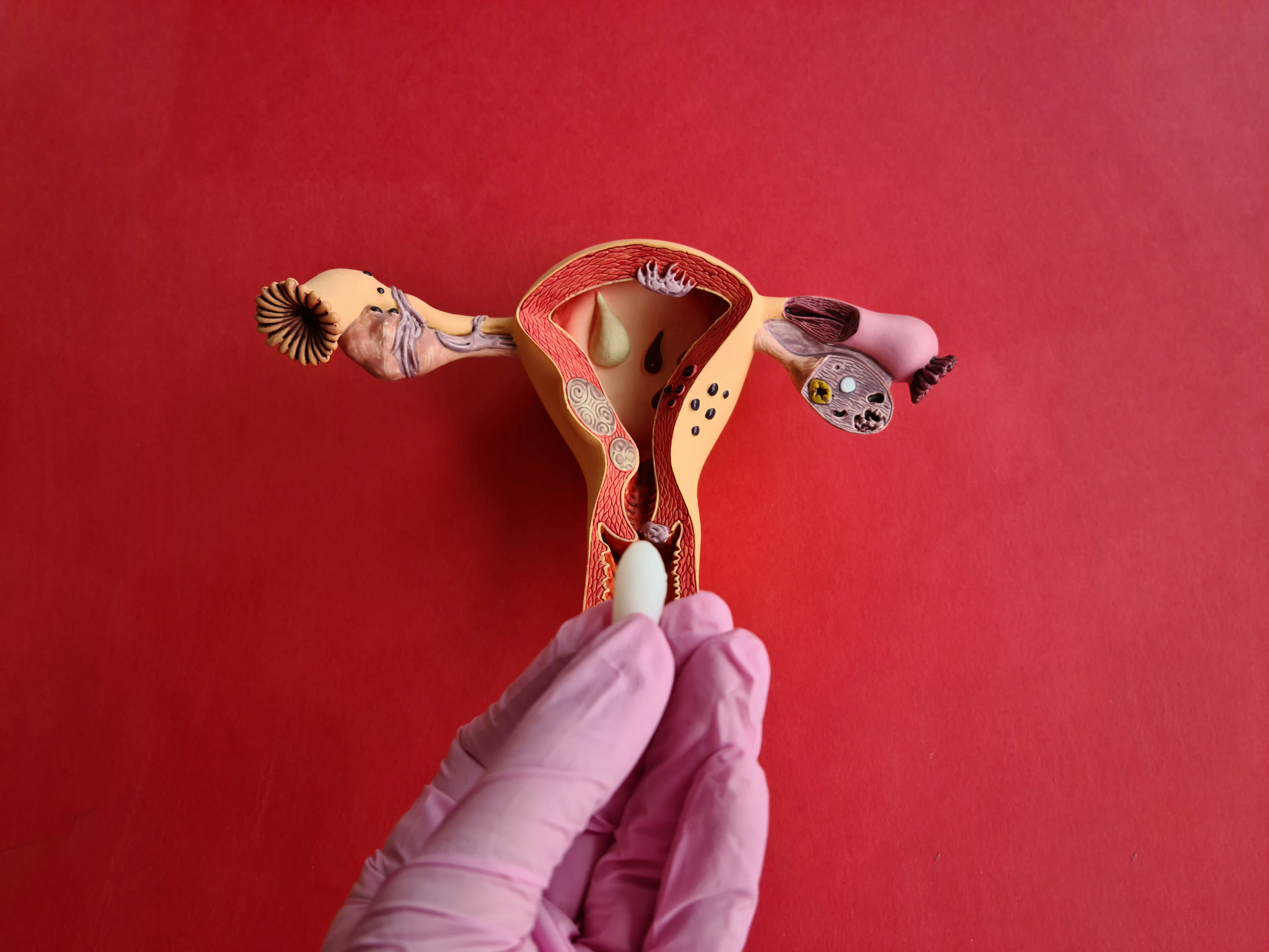 Rick Simpson Oil Suppositories: Benefits, Usage, and Risks